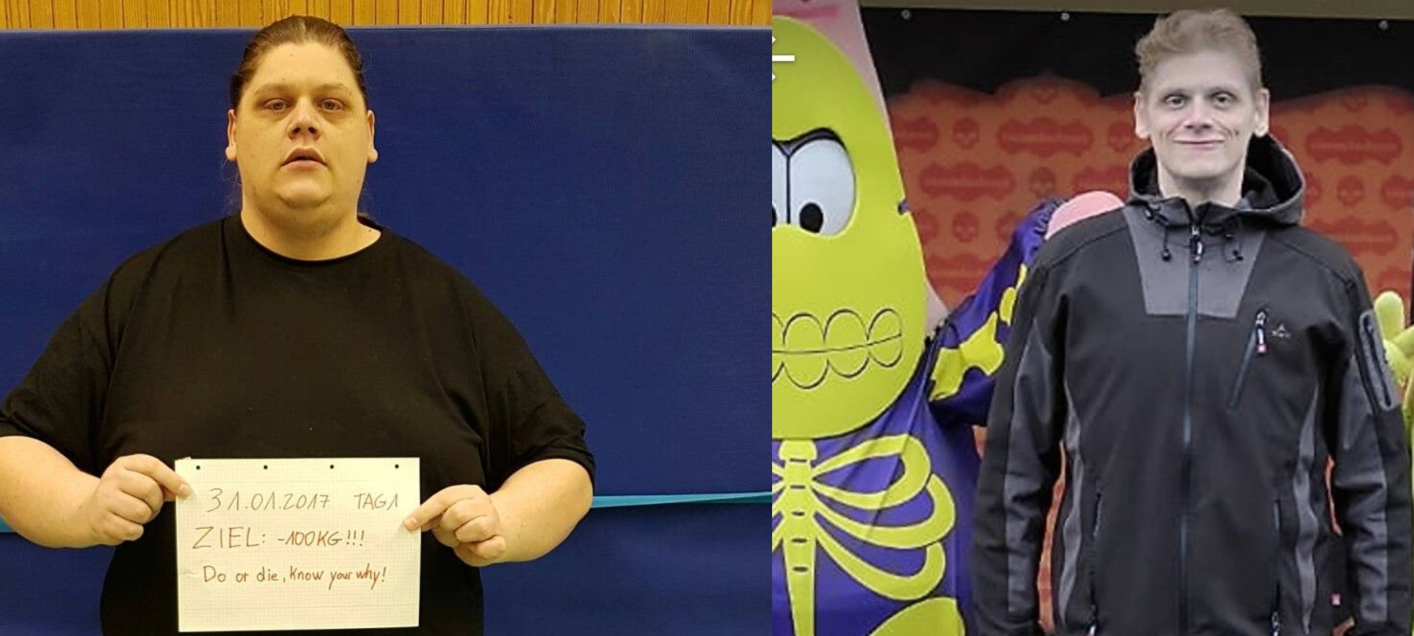 Adipositas Zentrum in Remscheid hilft Übergewichtigen