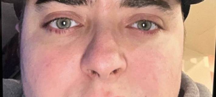 RS Vermisstensuchte nach dem 31-jährigen Sam Marian W. - Polizei bittet die Öffentlichkeit um Mithilfe